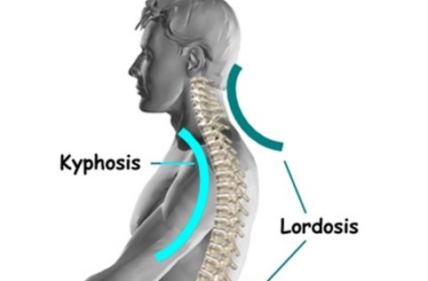 What’s the deal with spinal curvature – does it matter?